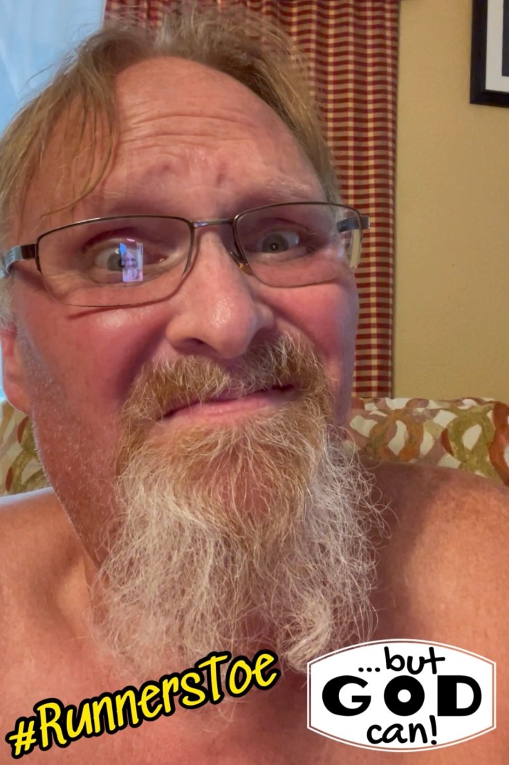 Healthy Lifestyle Problems: Runners Toe Finally Came Off…3 Months&nbsp;Later